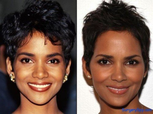 Halle-Berry-Plastic-Surgery-Before-and-After-1-500x374 | Pró-Corpo ...