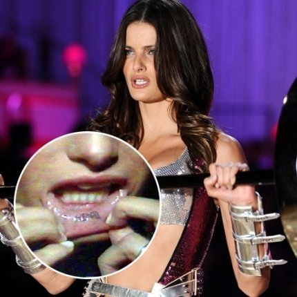 Após terminar o casamento com o ator Henri Castelli, a modelo Isabeli Fontana enfrentou o laser para remover o nome do ex. A tatuagem ficava na parte interna do lábio inferior.